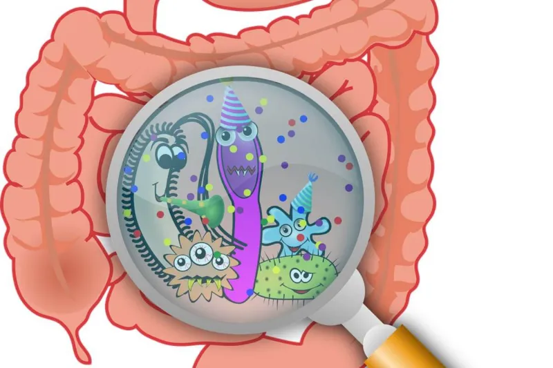 Schematische Darstellung einer SIBO (Dünndarm-Fehlbesiedlung). Vermehrte Bakterien im Dünndarm können nach dem Essen durch Fermentation von Kohlenhydraten starke Gasbildung und Blähungen verursachen.